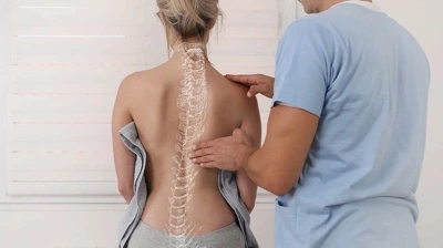 Кифоз лечение